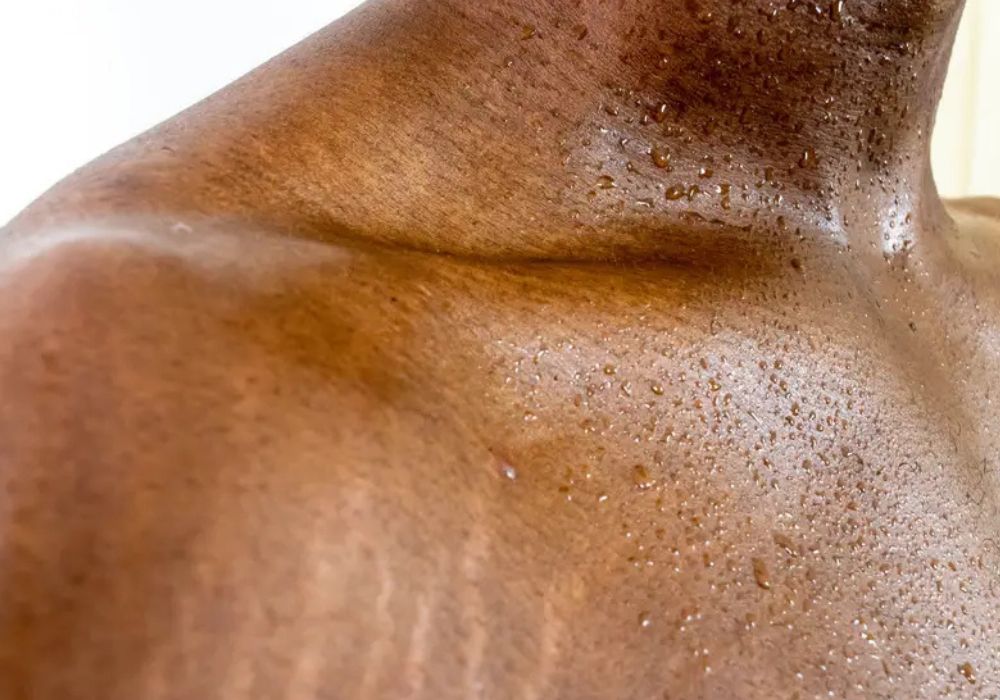 Melhores Produtos Para Prevenir Estrias no Ganho de Massa