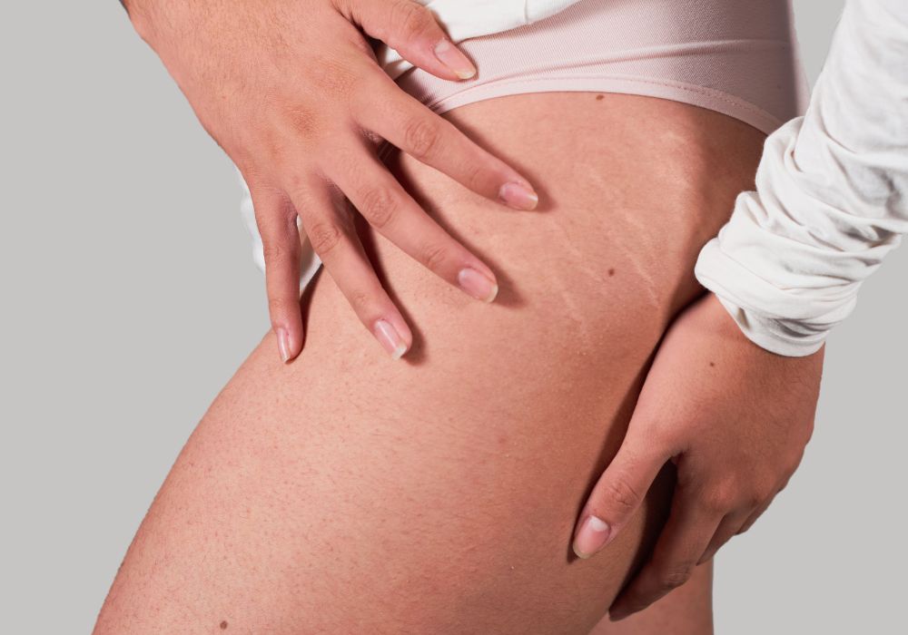 Como escolher o melhor procedimento estético para você