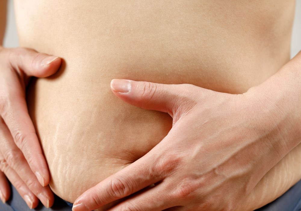 Cuidados Antes e Depois do Microagulhamento