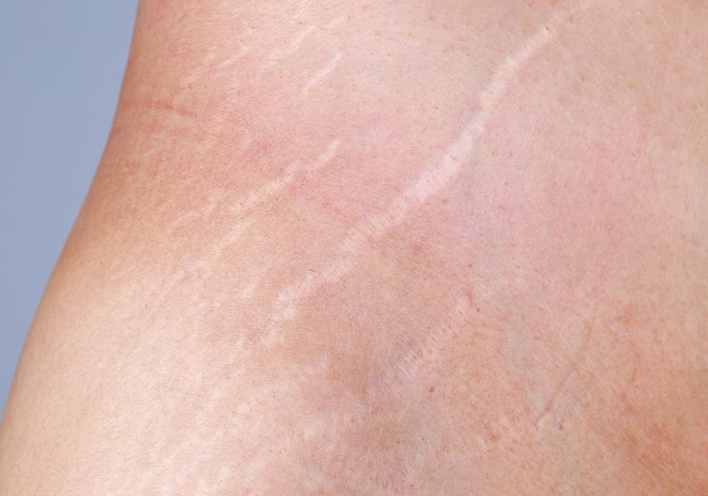 Qual é a melhor opção para você